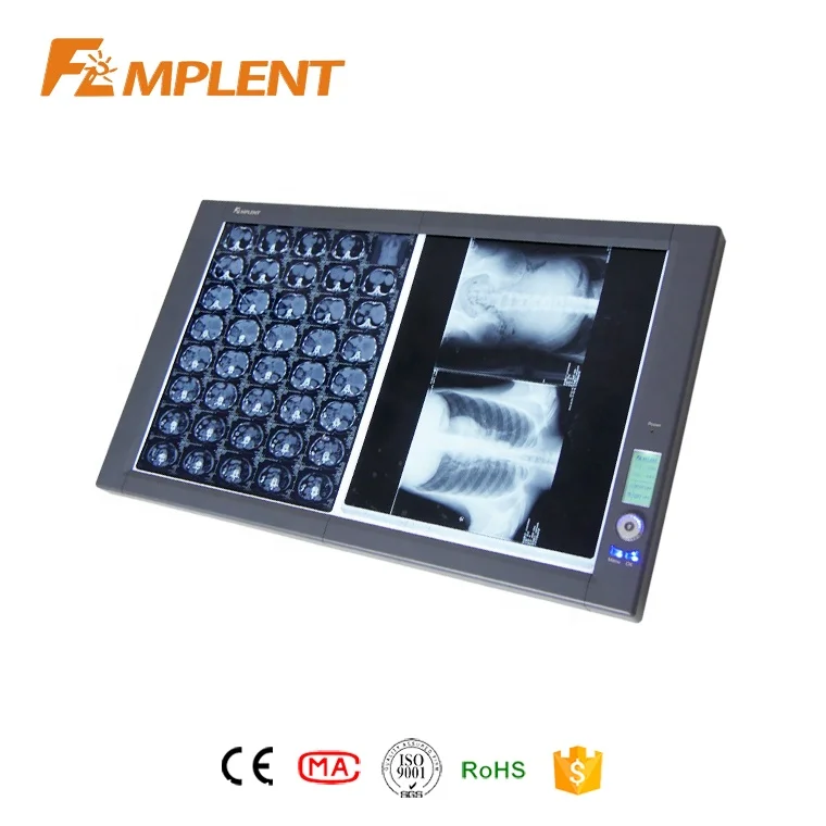 Mplent Ultra Bright LED Negatoscope X-ray film viewer medical equipment for hospital