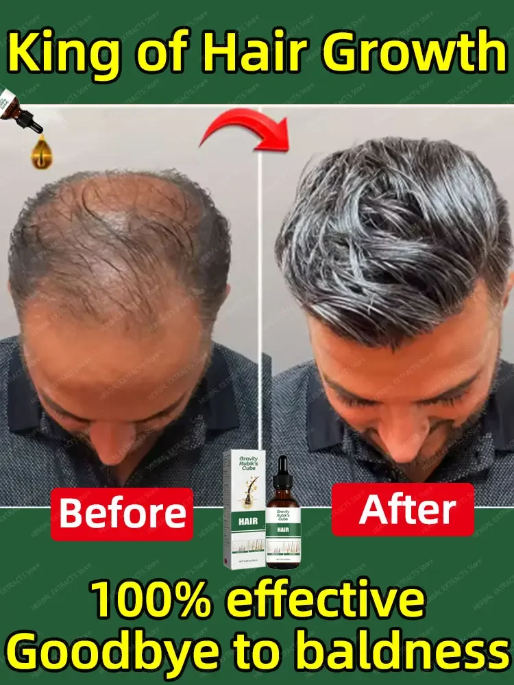 

The best hair growth products of 2025. Any hair loss and baldness problems can be solved and your hair will grow more than befor