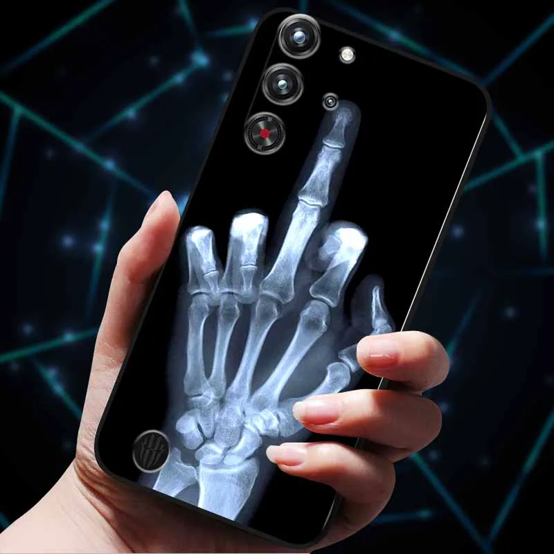 For ZTE Nubia Red Magic 10 Pro Plus Case 10Pro Luxury Fashion Soft Silicone Phone Case For ZTE Nubia Red Magic 10 Pro Cover Para