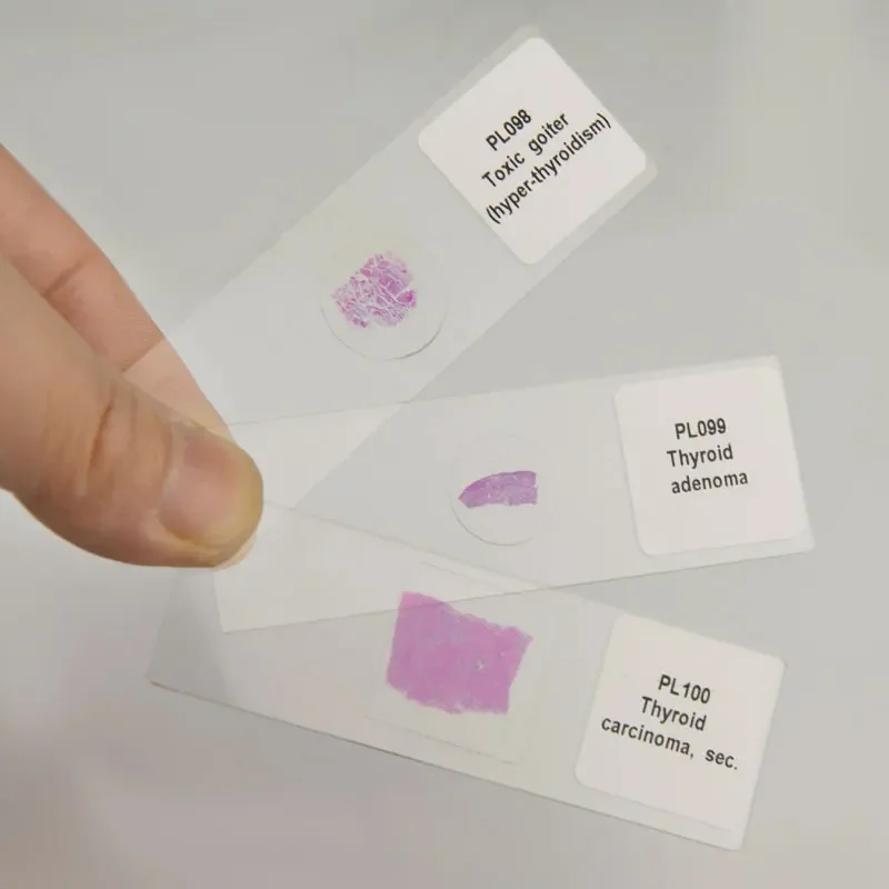 100 kinds Medical Pathological Sections of Human Body Typical Prepared Tissue Specimen Slides Microscope Glass Slice HE Staining