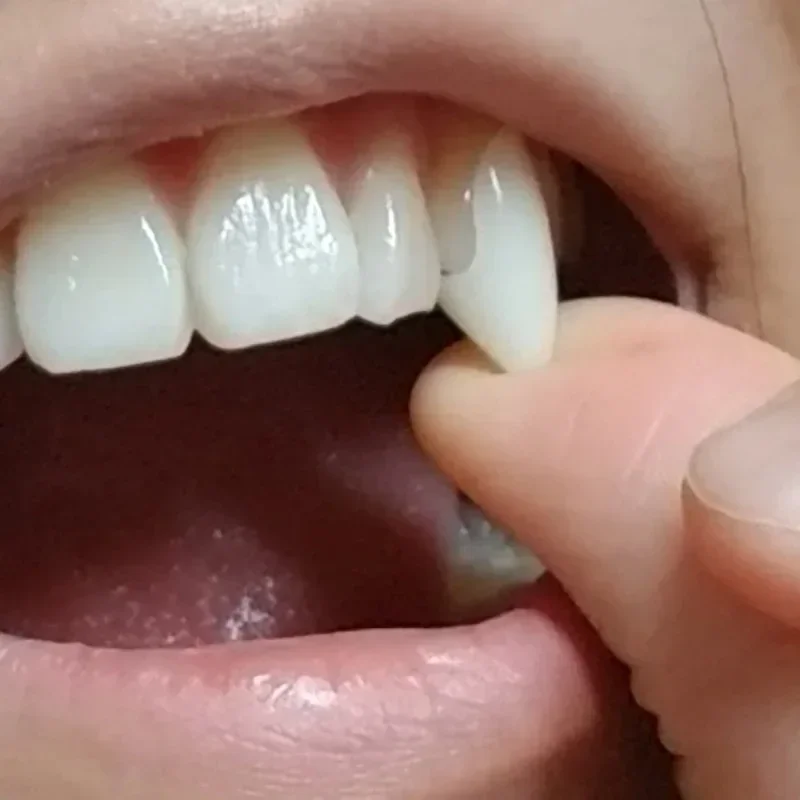 مجموعة أسنان مصاصي الدماء المخيفة - أطقم أسنان أنياب PP للهالوين الكلاسيكية للحفلات التنكرية والحفلات التنكرية والمفضلة المخيفة