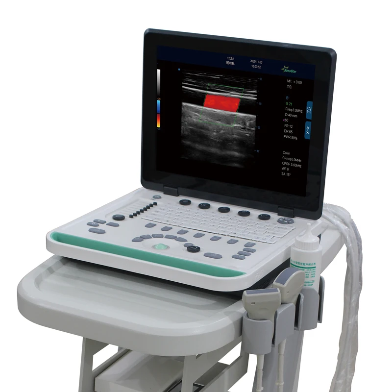 High Quality 15-inch Color Ultrasound Machine With Convex Array Probes For Medical