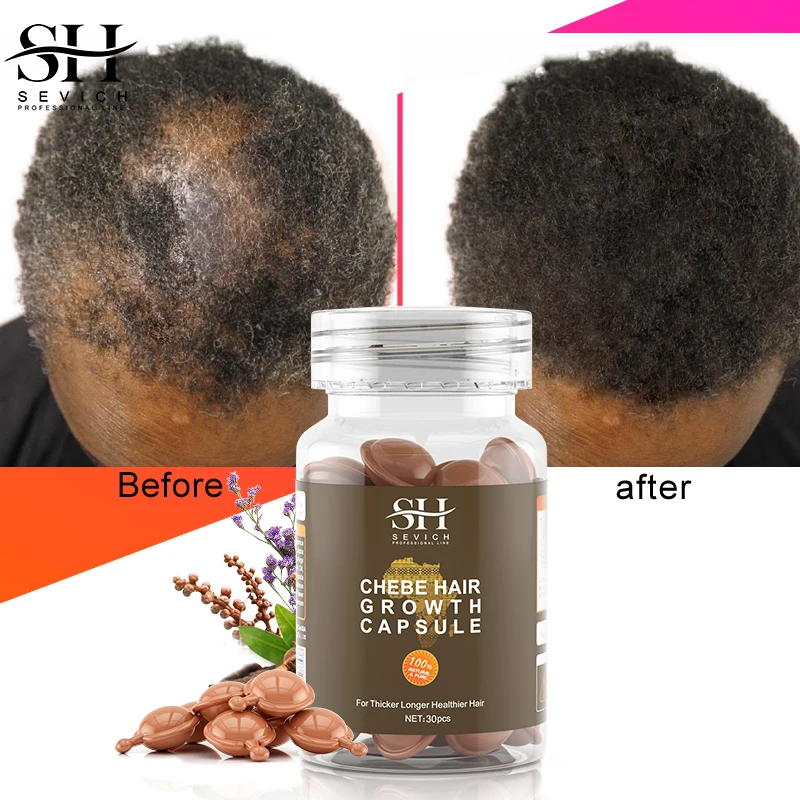 Hot Sale Chebe hair growth oil capsules African Traction Alopecia Treatment  Anti Hair Loss Strengthener Spray Get Rid Of Wigs