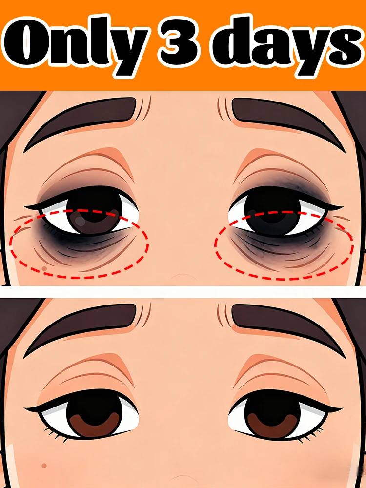 

[Эксклюзивная подруга] Пептидный восстанавливающий крем для глаз: удаляет морщины в течение 7 дней