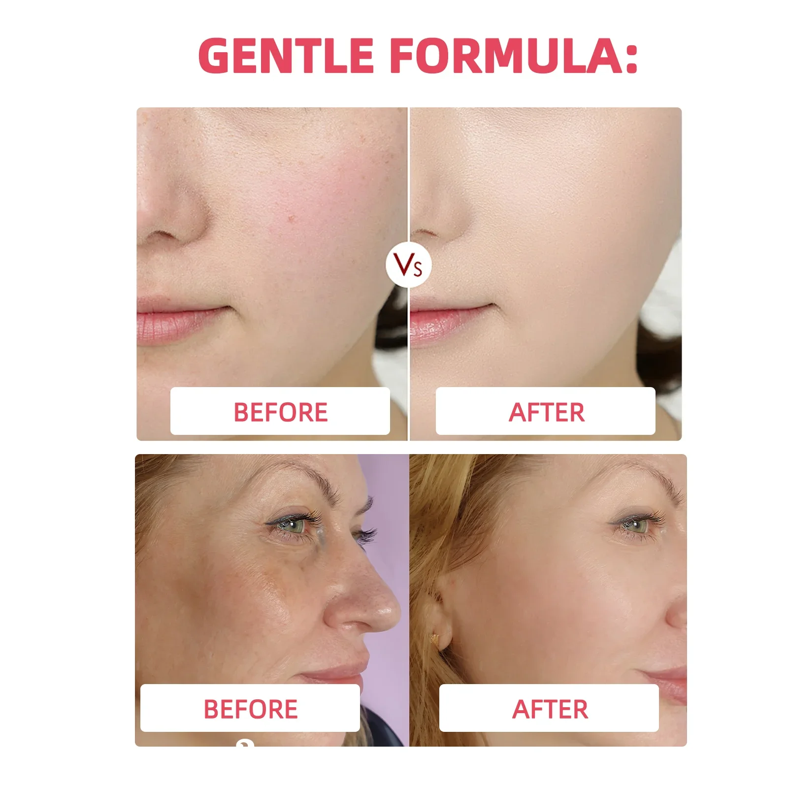 كريم PDRN Collagen Jelly - يشد البشرة ويعزز المرونة وسرعة تجديد الأنسجة. 7 تركيبة مجمعة بالكولاجين لمكافحة الشيخوخة. #3