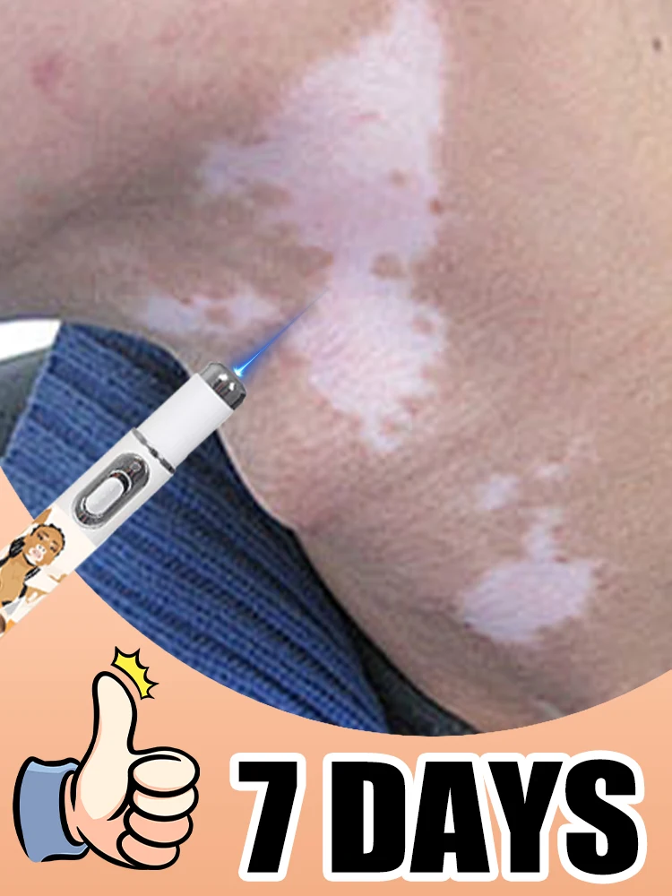 

The latest product is the blue light pen for Vitiligo and a Body care tool.