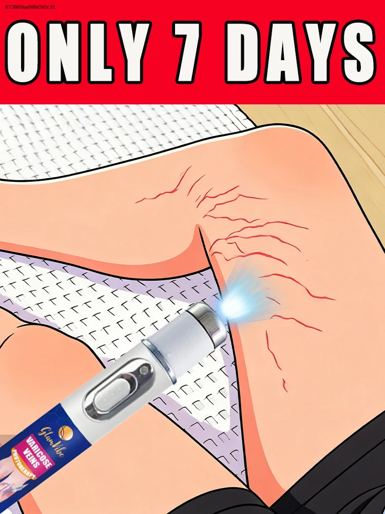 In 2026, the Blue Light Pen will be fully upgraded.