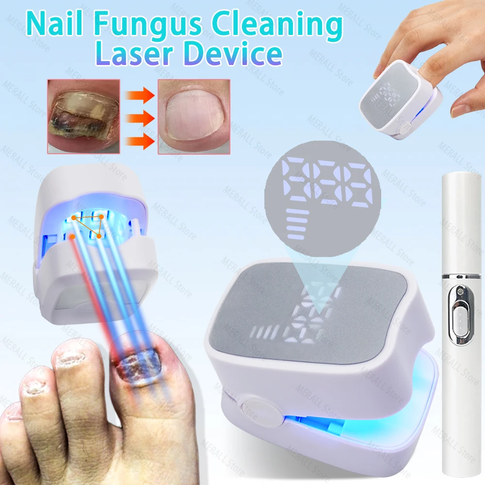 

Nail Fungus Laser Treatment Device Repair Effectively Remove Nail Fungal Infection Anti-Equipment Nail Fungus Treatment Tools