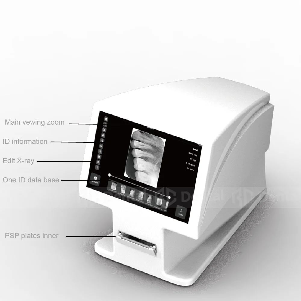 Dental PSP Skaner Czujnik rentgenowski Cyfrowe obrazowanie wewnątrzustne System skanowania płyt fosforowych ISO Dentalink Dimage Scanne