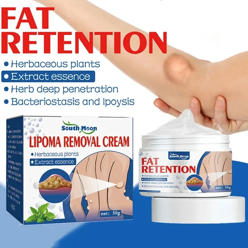 Lipoma Removal Cream Reduce Inflammation Treat Subcutaneous Lumps Relief Pain Anti Tumor Improve Fat Nodule Remove Skin Swelling