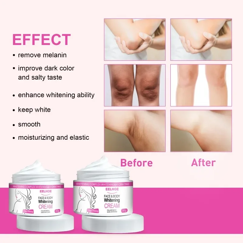 Face Body Whitening Brightening Cream Thigh Underarm Inner Melanin Lightening Lotion Feminine Gentle Nourishing Skin Care Cream