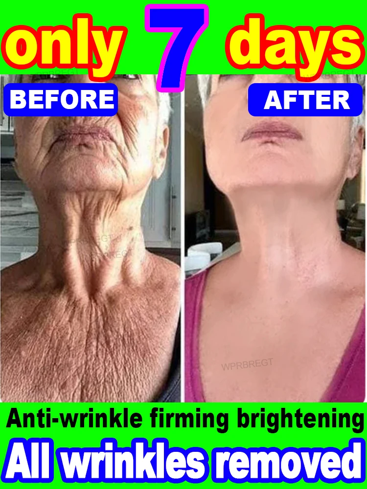 20 years younger, 100% wrinkles disappear