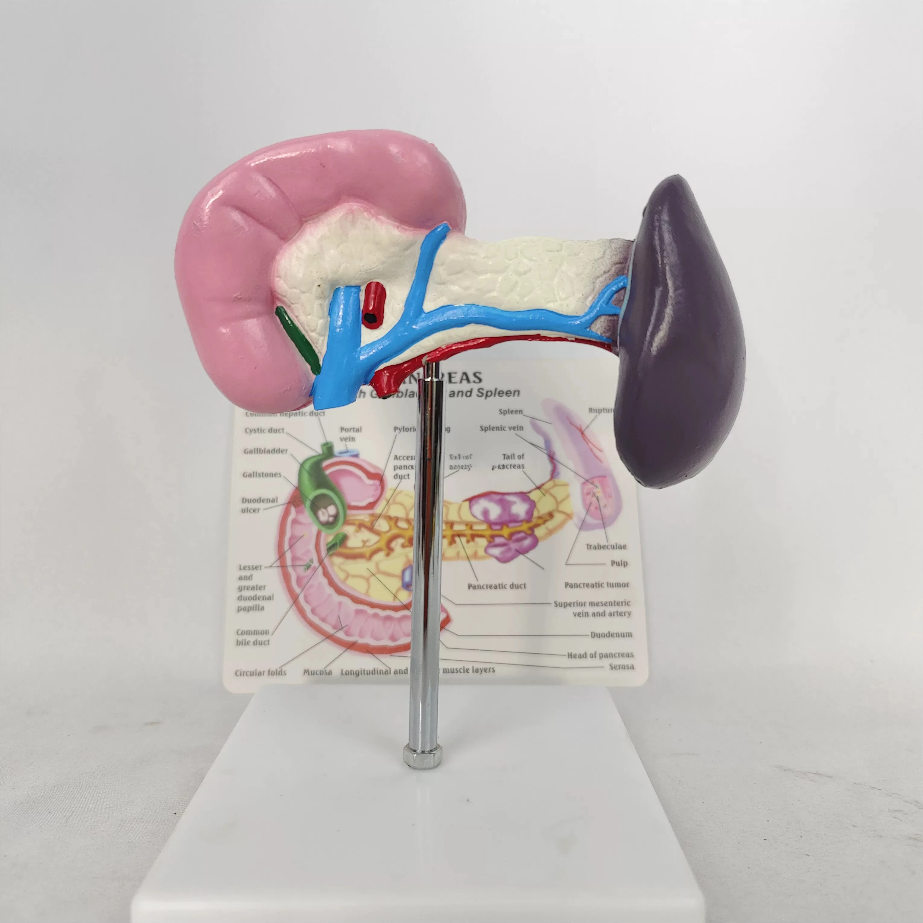 Human One To One Healthy Spleen Pancreas Pancreas Model Human Internal Organ Anatomy Demonstration Medical Appliances