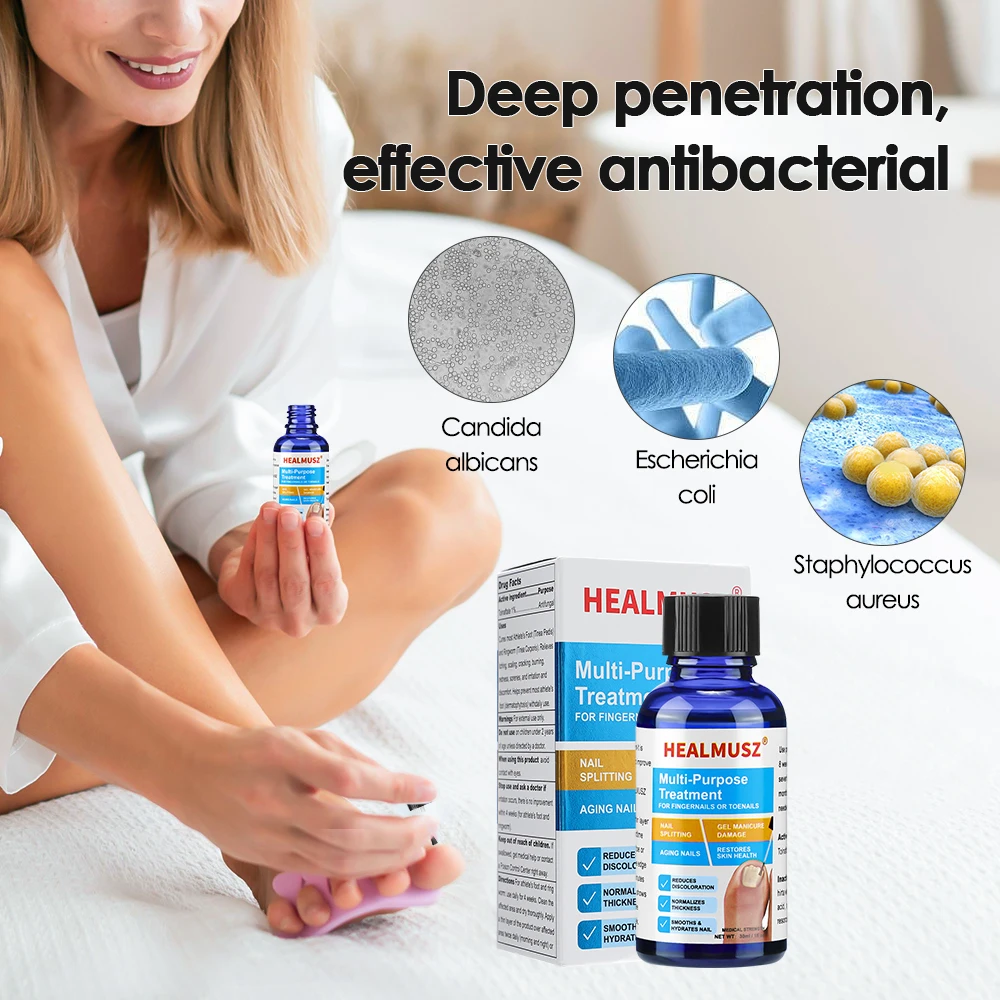 30ml เท้าเล็บเชื้อรา Treatment Toenail Repair Essence Serum Liquid ฟุต Toes Care เครื่องมือเชื้อรา Removal