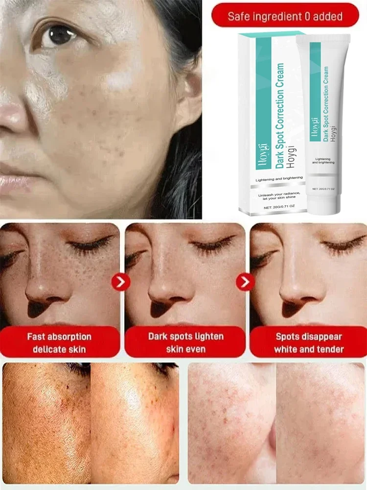 Krim Pemutih Penghilang Titik Kuat Mencerahkan Kulit dengan Cepat Menghilangkan Pigmentasi Melanin Melasma Bintik Hitam Melembabkan Gel Kecantikan