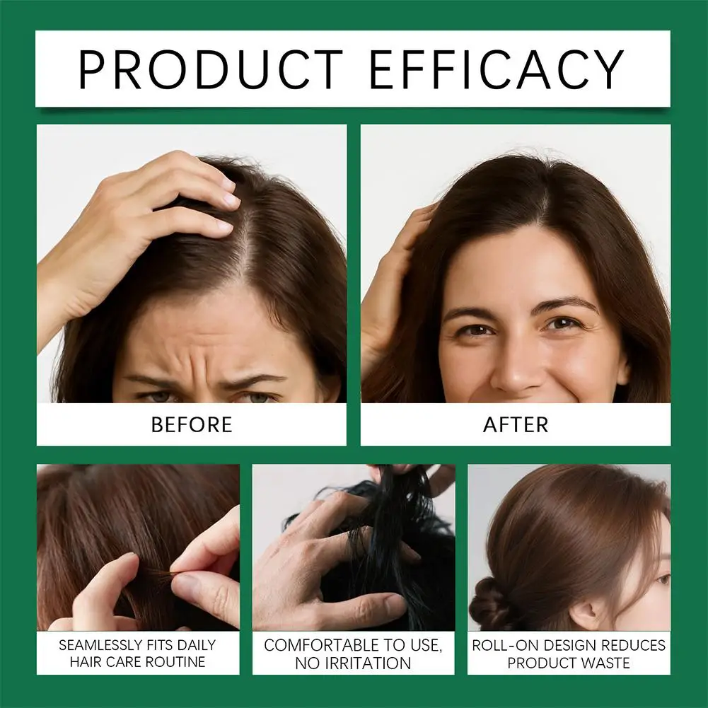 جوهر العناية بالشعر 20 مللي مصل لفة على علاج فروة الرأس مكافحة تساقط الشعر تركيبة سماكة مستخلص نباتي طبيعي العناية #4