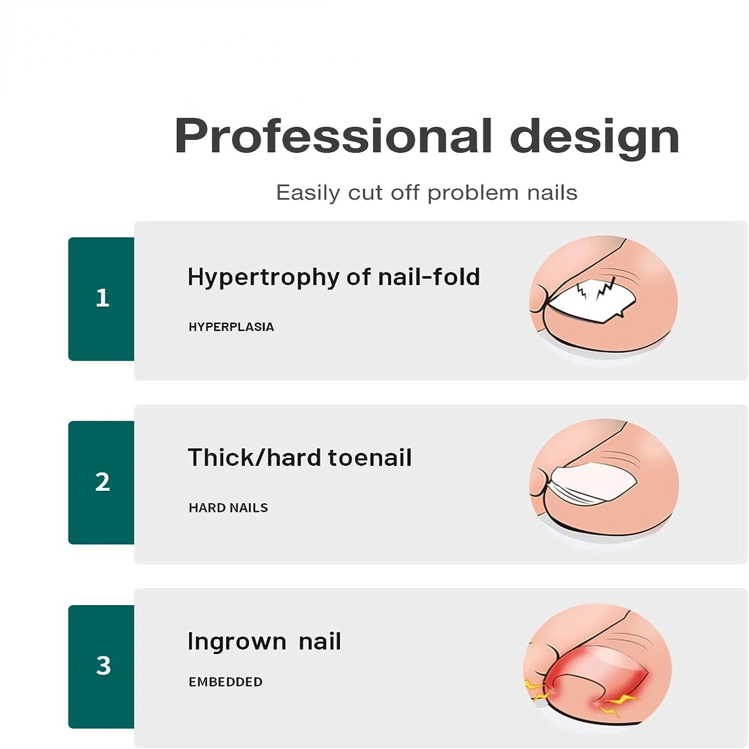 Cortador de uñas encarnadas de acero inoxidable para manicura y pedicura precisos: artesanía superior para uñas gruesas - Perf de alta calidad