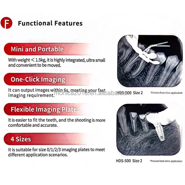 Modern Denta Products Hospital Instruments Phosphor Plate Scanner HDS-500 Digital Imaging Plate Scanner With 3pcs Plates