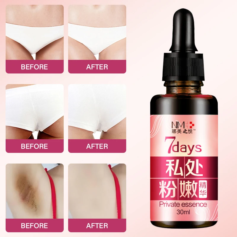 Suero Rosa privado para el cuidado de la piel para hombres y mujeres, eliminación de pigmento profundo, blanqueamiento, brillo, zona del Bikini de las articulaciones de las axilas, 30ml