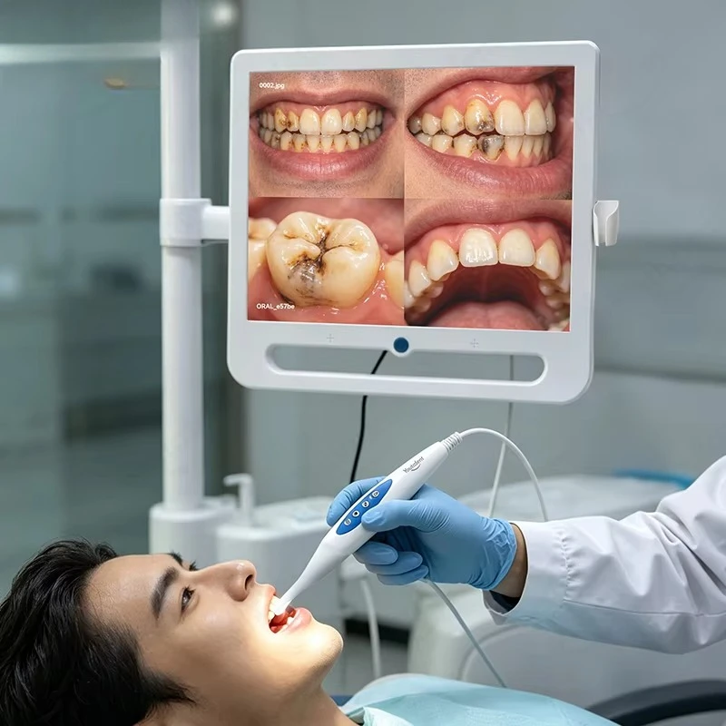 Dental Endoscope Oral Camera 17 Inch Portable Electric Medical Equipment with Full HD Electric Oral Camera for Dental Treatment
