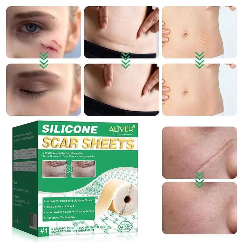 150cm Silicone Gel Scar Sheet Patch Treatment Removal Tape Repair Section Skin Burn Beauty Cover Trauma Ear Acne Scar P3v3