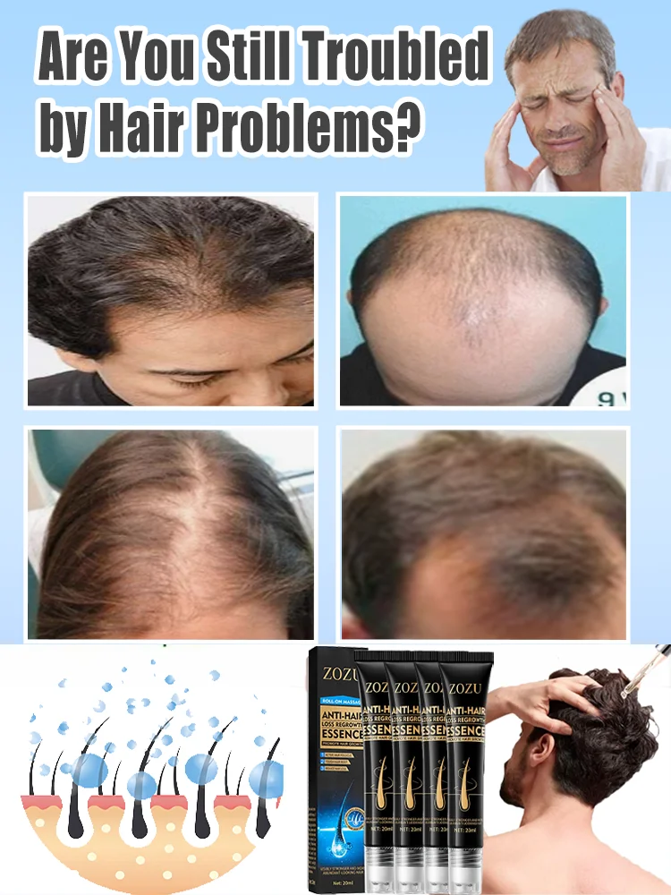 Fast Hair Growth Essence Effective Anti Hair Loss Serum Baldness Repair Hereditary Postpartum Seborrheic Hair Care