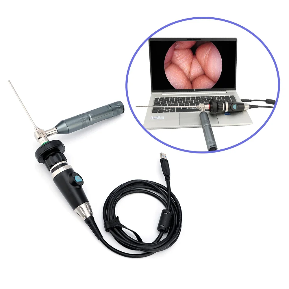 Hot sales endoscope camera portable, USB endoscope for Laptop, ent endoscope camera portable endoscopy