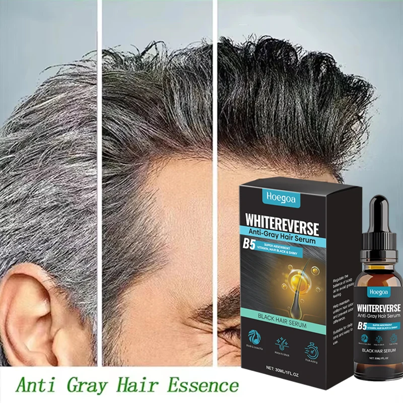 

Новая сыворотка для лечения серо-белых волос, покрывающая белые волосы черного цвета, натуральный восстанавливающий спрей против выпадения волос, восстановление здорового ухода за волосами