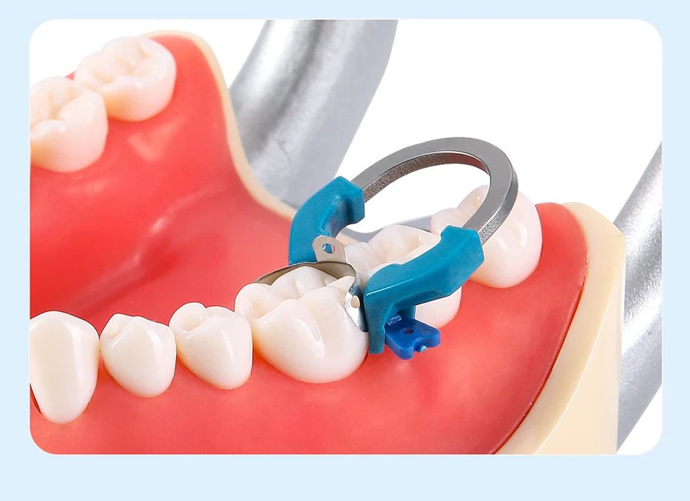 3-teiliges AZDENT Dental-Sektionsmatrizesystem, Matrizen, Clip-Ring, konturierte Matrizenbänder, Titan-Klemmring, universell schmal, tief – Detail 9