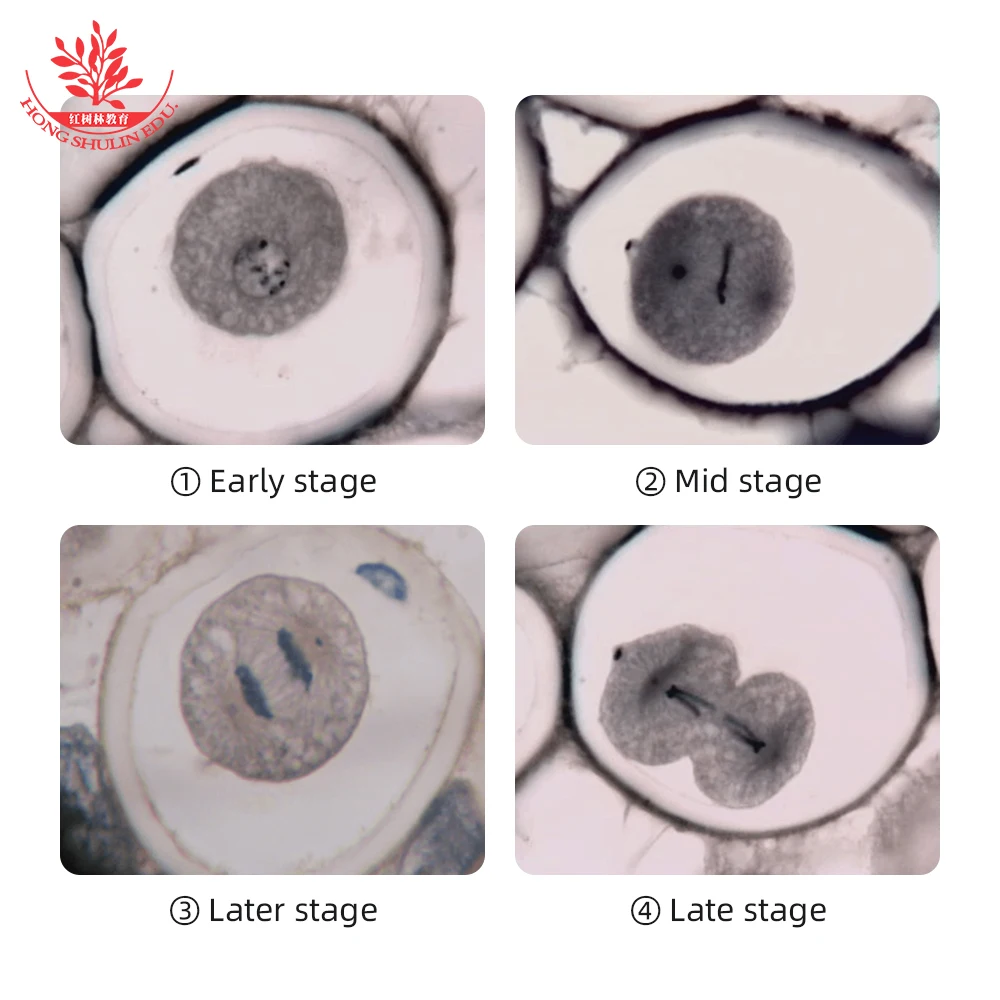 Prepared Slides Transverse Section of Uterus of Ascaris Euqi (Centrosomes)Cell Mitosis Slide Clearly for Animal Genetics Biology