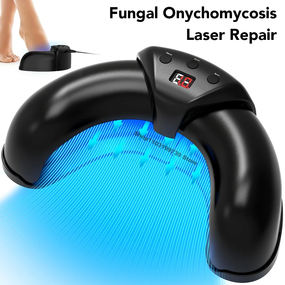 爪真菌レーザー装置複数の足の爪 905nm470nm 7 分無痛陥入爪カルシウム爪真菌治療を除去