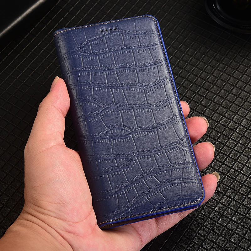 

Crocodil Belly Phone Case For Samsung Galaxy A54 A34 A24 A14 A04 A73 A53 A33 A23 A13 A03 Flip Wallet Shell Book Cover