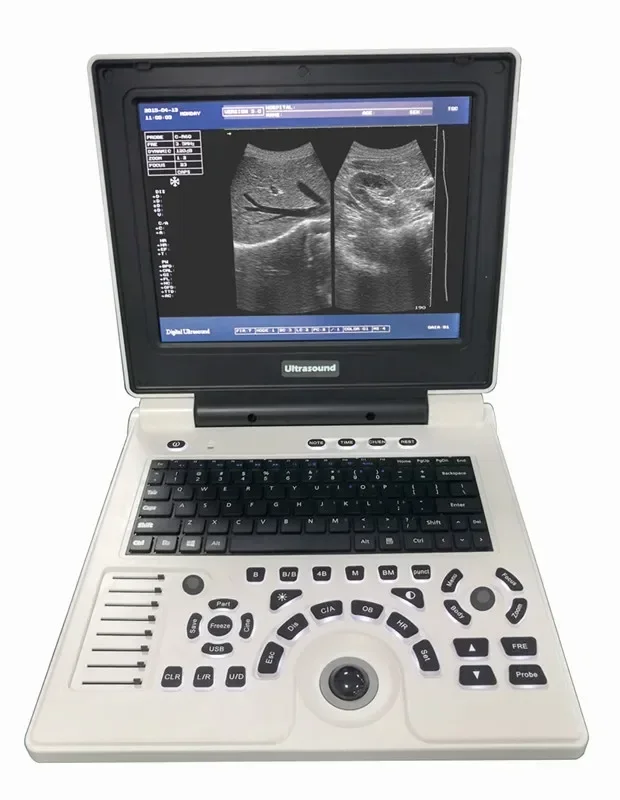 

Veterinary Ultrasound Equipment Ultrasound Machine Black and White Cheap Price Portable Ultrasound Scanner