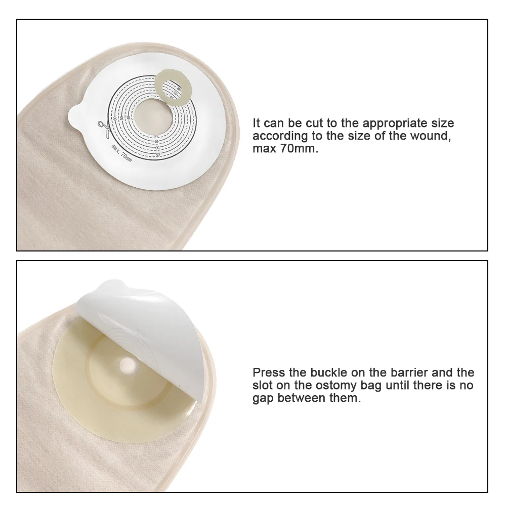 70mm 10pcs Bags One Piece Ostomy Supplies Colostomy Bags Drainable Pouches with Hoop and Look Stoma Care
