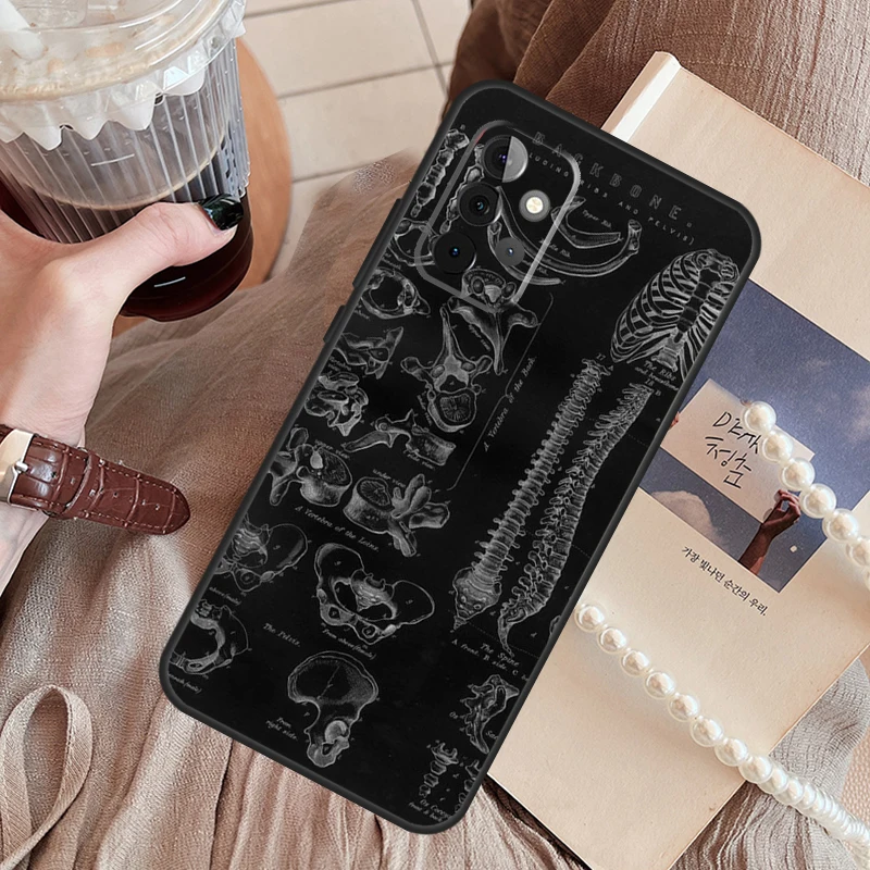 Radiological Human Organs Skeleton Funda Phone Case For Samsung Galaxy A14 A13 A12 A54 A53 A52 A34 A33 A32 A24 A23 A22 A51 A71