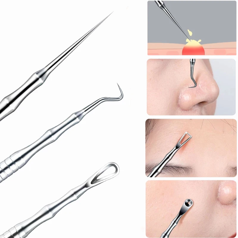 1/2/3 Uds. Pinza alemana ultrafina para espinillas, espinillas, Clip para espinillas, salón de belleza, herramienta especial para eliminar partículas de grasa y acné