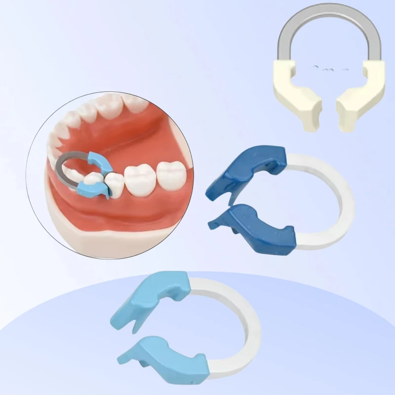 

Multi type Dental Sectional Matrix System Matrices Clip Ring Niti Matrix Clamp Clip Sectional Contoured Matrices Dentist Tool