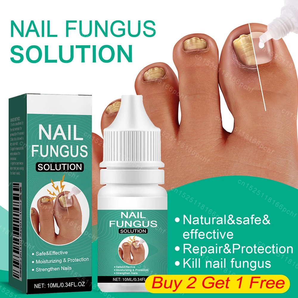 Sérum de traitement des champignons des ongles, bain supplémentaire, huile d'essence pour les pieds, soin réparateur, crème anti-infection, Parker, gel d'élimination des champignons, N64.