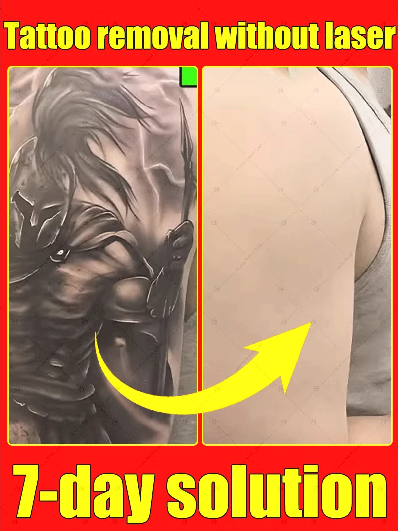 真皮を傷つけることなくタトゥーを目に見えるほど明るく、安全で優しい