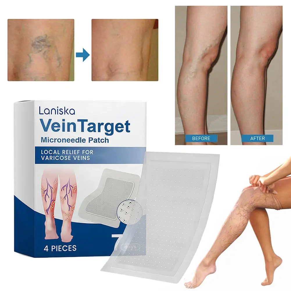 Varicose Vein Relief Patches with Cooling Plant Extracts Non Greasy Promotes Blood Circulation Lightweight Easy to Apply view 3