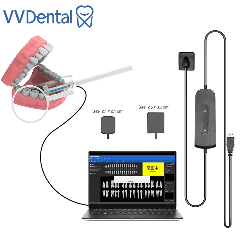 

VVDental Dental Sensor X-Ray Radiovisiograph Digital Sensor Intraoral Imaging System HD Image Dentistry Equipment