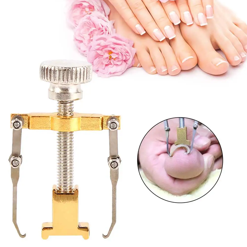 Recuperador de unhas encravadas correção de unhas pedicure fixador portátil corretor de joanete de unhas metal ferramenta de cuidados com os pés