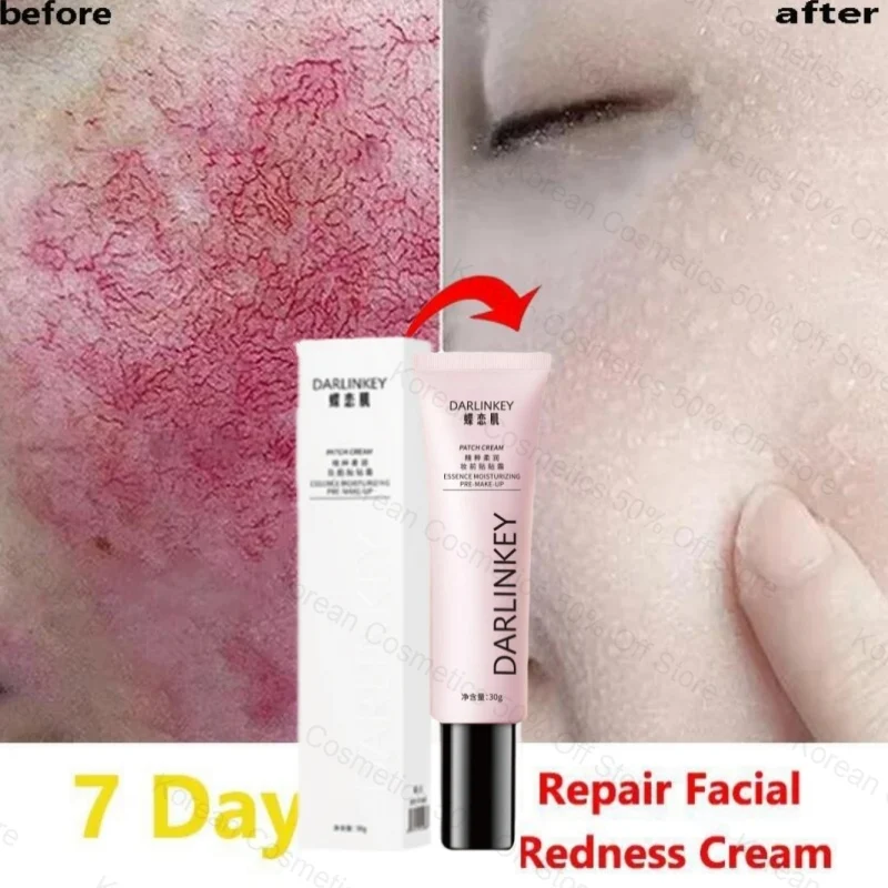 

Facial Anti-Redness Concealer Day Cream Sooth Itching Sensitive Redness Prone Skin Care Cream Moisturize Brighten Base Cosmetics