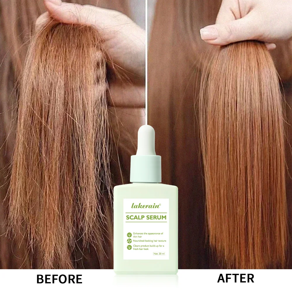 

Hair Essence Hair Growth Serum With Amino Acids Rosemary Oil Reduces Scalp Oil Buildup Non Greasy Treatment For Thinning Hair