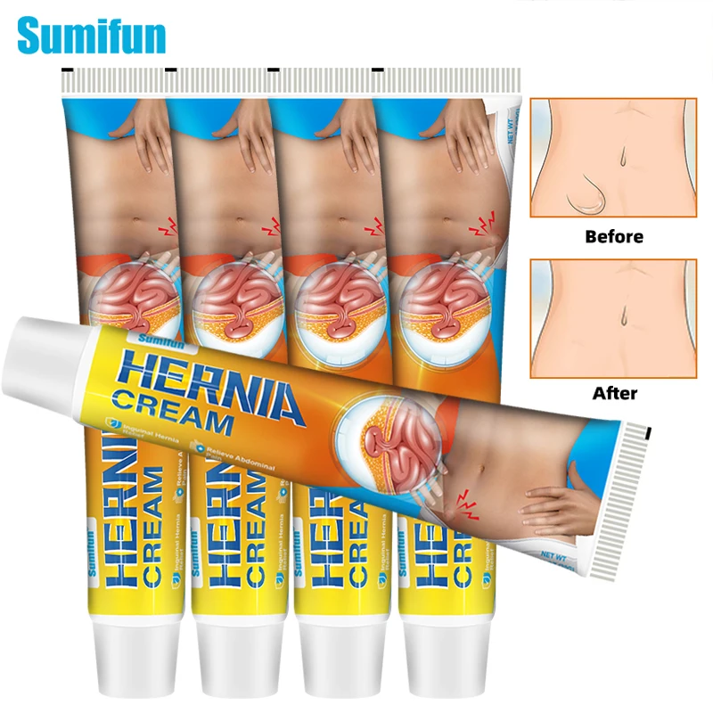 

Hernia Cream Remove Umbilical Femoral Inguinal Tumor Ointment Inguinal or Scrotal Mass Anti Swelling Relief Medical Plaster Care