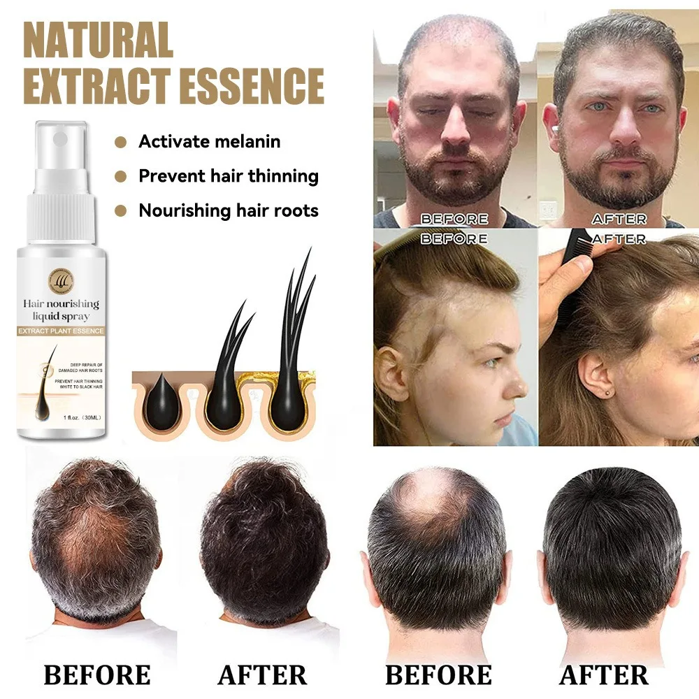 Hair Growth Serum Oil Loss Regrowth Treatment Strengthens Hair Nourishes Scalp No Greasy Improve Scalp Circulation Beauty Health