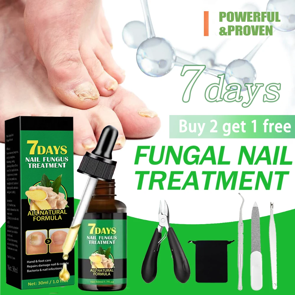 7DAYS Fungal Nail Treatment Essence Oil Anti-Fungus Onychomycosis-Removal Liquid Ginger Foot Antifungal Nail Treatments 30ml