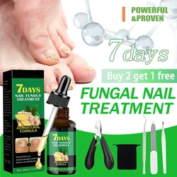 Óleo de Essência para Tratamento de Unhas Antifúngicas, Antifungos, Onicomicose, Líquido Remoção, Pé de Gengibre, Antifúngico, Tratamentos, 30ml, 7 Dias