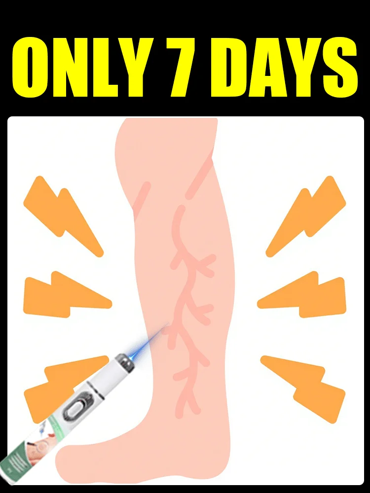 

Blue light vein therapy Say bye to vasculitis, phlebitis, spider leg pain, varicose veins