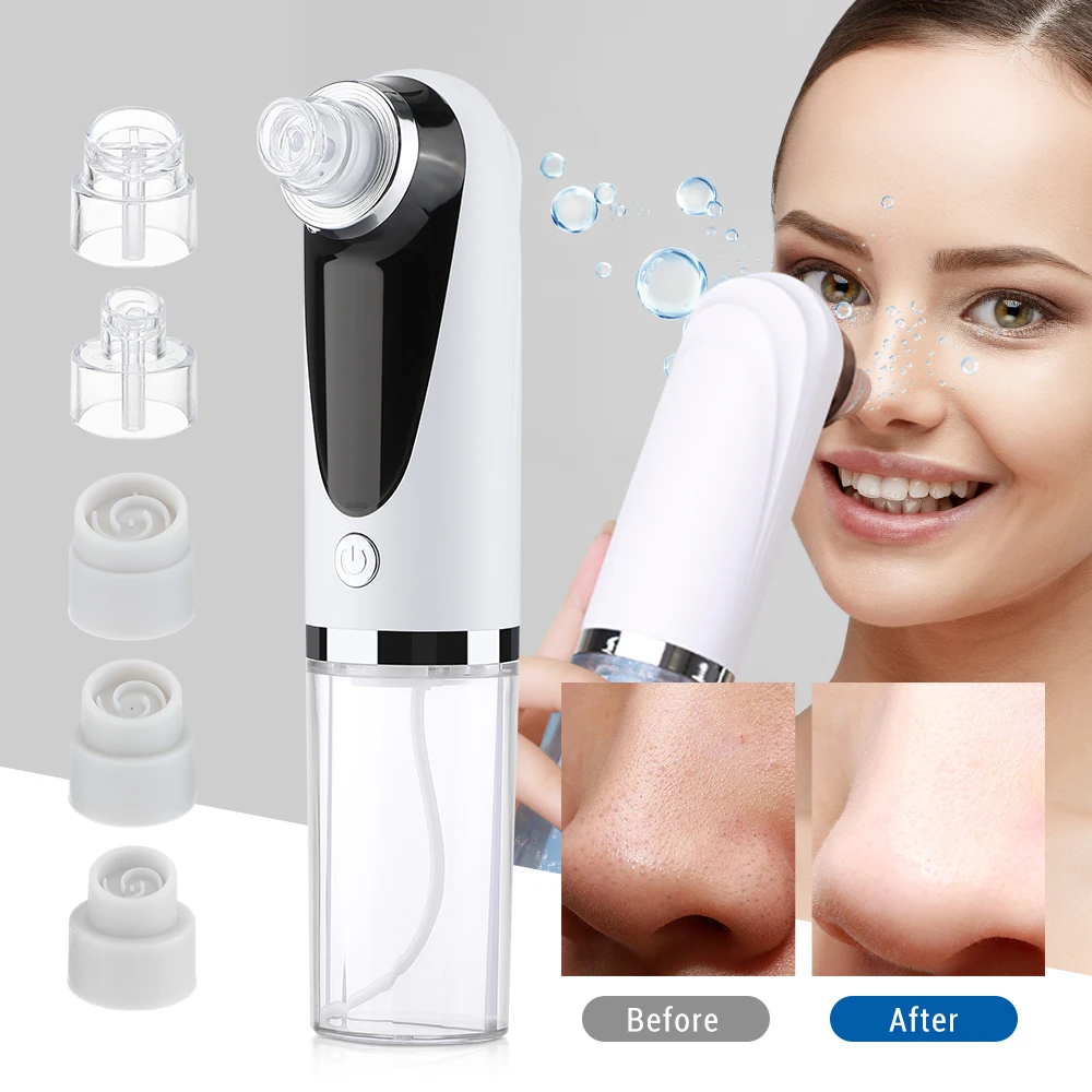 Blackhead Remover Pore Vacuum Cleaner Electric Micro Small Bubble Facial Cleasing Machine USB Rechargeable Beauty Device